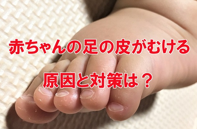 赤ちゃんの足の皮がむける原因と対策